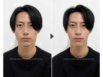 リンドウ 赤坂店(RINDO)の写真/国家資格保持者による施術で歪み、むくみを整え、理想のフェイスラインへ導く小顔ケア◎