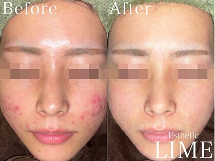 ライム 柏(LIME)の写真
