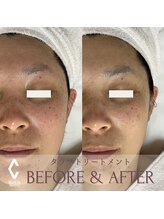 クラームビューティー(Clerm beauty)/リアボーテタラソトリートメント