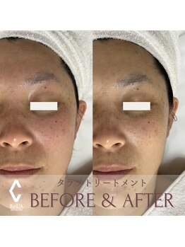クラームビューティー(Clerm beauty)/リアボーテタラソトリートメント