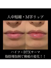 クリニカルボーテ 心斎橋院(CLINICAL BEAUTE)/痛みなし！可愛い唇造形！