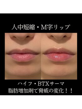 クリニカルボーテ 心斎橋院(CLINICAL BEAUTE)/痛みなし！可愛い唇造形！