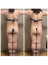 カーロ(CARO)/痩身BA★上半身5回/尻2回