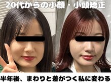 ラクタイセイタイイン 梅田茶屋町店(楽体整体院)/20代からの小顔施術で差をつける