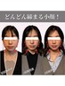 【エラ/歪み改善】 小顔集中改善コースお試し 約75-90分