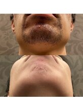 フェリーバ 流山店(FELIVA)/お肌も良くなります♪