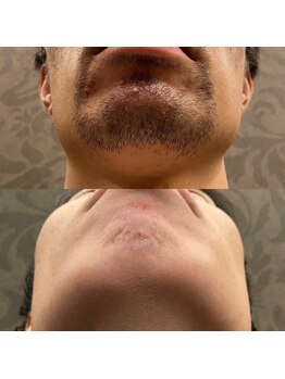 フェリーバ 流山店(FELIVA)/お肌も良くなります♪