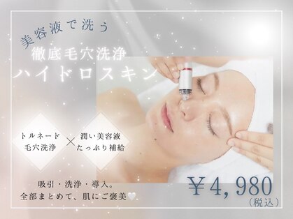 イルナ(ILUNA)の写真