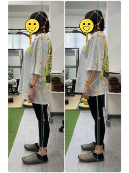 サンシー整体(SunCY整体)/腸もみで姿勢改善