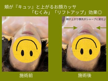 水玉屋(suidamaya)/頬が「キュッ」とあがります♪