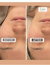 リノ 西宮北口店(Lino)/