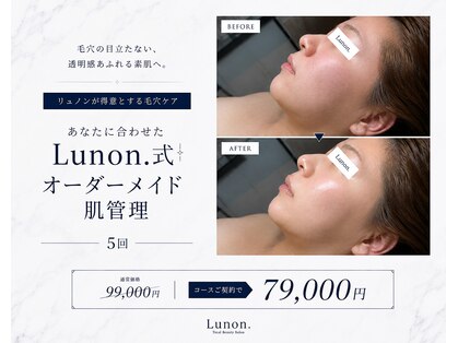 リュノン(Lunon.)の写真
