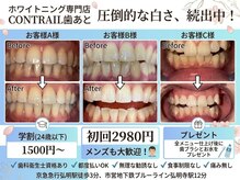 コントレール 歯ぁと(CONTRAIL)
