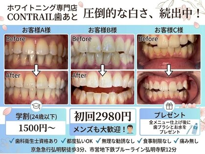 コントレール 歯ぁと(CONTRAIL)の写真