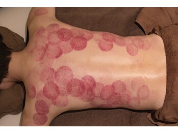 リモデ(Re MODE)/濃い色ほど悪いです