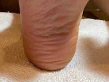 ビサンテ サロン/中々良くならない踵もスベスベ！