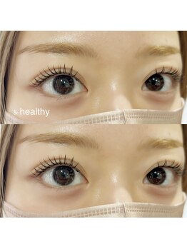 シーディーエム(cdm)/&ヘルシー