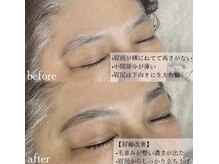 カワル(Kawaru)/ハリウッドブロウリフト/HBL