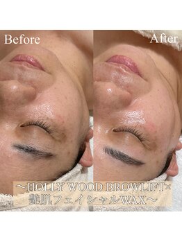 エレーナ(ELENA)/艶肌フェイシャルWAX＋HBL