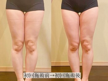 アンジー(Angie)/1回で脚のシルエットが変わる