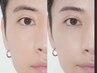 【メンズ｜ヒゲ｜毛穴｜眉毛】男の身だしなみケアがお得に◎¥9900→¥8000
