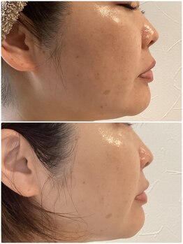 フォーユー 飯能店(Foryou)/艶肌☆セルマン