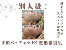 エステティック レイビス 銀座店(RAYVIS)/