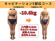 ビーバランス 本町店(美-Balance)/50代前半　月5部位コース