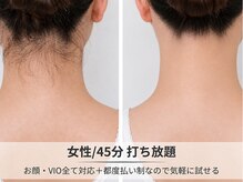 フルーブラン(Frubran)/【女性】45分好きな部位打ち放題