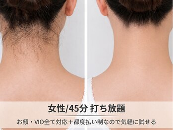 フルーブラン(Frubran)/【女性】45分好きな部位打ち放題