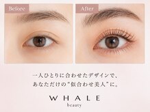 ウェイルビューティー(WHALE beauty)