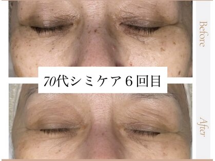 サロンドボーテ ベル(SALONDEBEAUTE BELLE)の写真