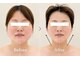 ループス(Roops)の写真