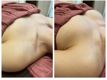 ソラ(sora)/寝てもフワフワバスト★