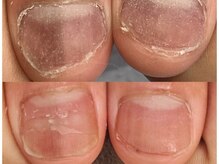 グレースレディ/よく触ってしまう指も