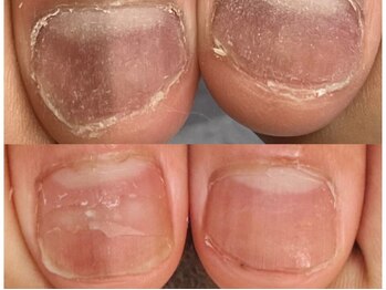 グレースレディ/よく触ってしまう指も