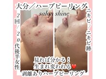 サロンシャイン(Salon Shine)
