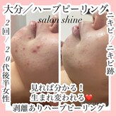 サロンシャイン(Salon Shine)