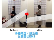 ハピフル整体院 塚本院/【◎骨盤矯正 × EMS】