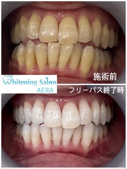 アエラ(AERA)/【大人気！フリーパスコース】