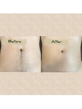 レルア(Relua)/気になる場所もスッキリ！