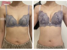美人バスト 浜松店/◇ バストアップ &nbsp;BeforeAfter◇