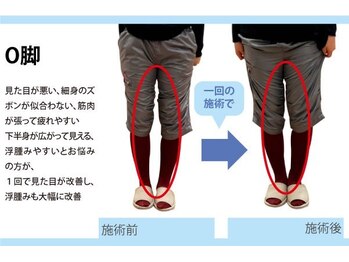 セルフケア整体 新宿店/