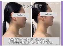 ルリアン(Lurian)/たった1回60分でここまで変わる