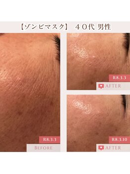 エクラ アン(eclat.un)/ゾンビマスク 40代男性