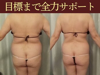 ハバック 宇部店(HBACC)/目標まで全力サポート