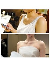 クオン(kuon)/猫背改善ビフォーアフター