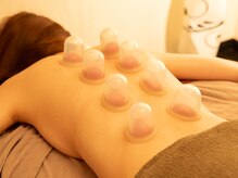 ザ フェイス 横浜桜木町店(THE FACE)/背中シリコンカッピング