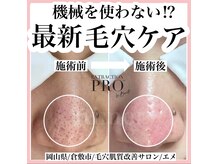 エメ(Aimer)/最新毛穴ケア