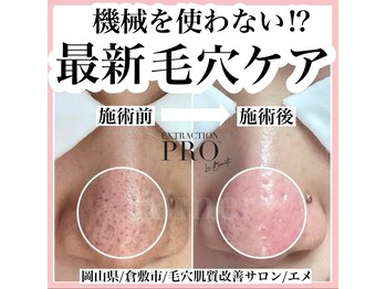 エメ(Aimer)/最新毛穴ケア